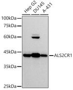 ALS2CR1 Recombinant Rabbit Monoclonal Antibody (7R4J9)