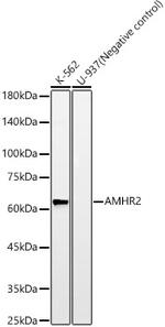 AMHR2 Recombinant Rabbit Monoclonal Antibody (7R5V8)