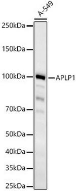 APLP1 Antibody in Western Blot (WB)