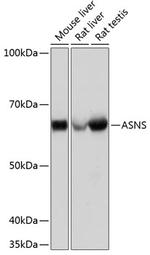 Asparagine Synthetase Recombinant Rabbit Monoclonal Antibody (7M10Z7)