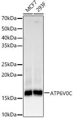ATP6V0C Recombinant Rabbit Monoclonal Antibody (3C7J3)
