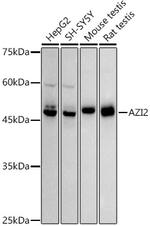 AZI2 Recombinant Rabbit Monoclonal Antibody (4Q9V9)