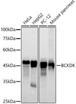 BCKDK Recombinant Rabbit Monoclonal Antibody (5J3L3)