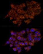 FGFR1OP Antibody in Immunocytochemistry (ICC/IF)