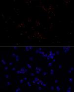 FGFR1OP Antibody in Immunocytochemistry (ICC/IF)