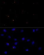 FGFR1OP Recombinant Rabbit Monoclonal Antibody (2T2F9)