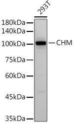 CHM Recombinant Rabbit Monoclonal Antibody (2F7W2)