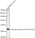 GSDMB (Cleaved) Antibody in Western Blot (WB)