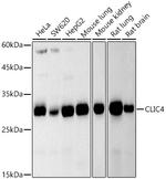 CLIC4 Recombinant Rabbit Monoclonal Antibody (6O0W5)