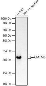 CMTM6 Recombinant Rabbit Monoclonal Antibody (6K8M9)
