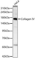 Collagen IV Recombinant Rabbit Monoclonal Antibody (3V3N3)