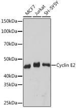 Cyclin E2 Recombinant Rabbit Monoclonal Antibody (0Y7G5)