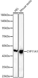 CYP11A1 Recombinant Rabbit Monoclonal Antibody (6G3S1)