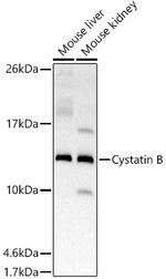 Cystatin B Recombinant Rabbit Monoclonal Antibody (2O8T3)