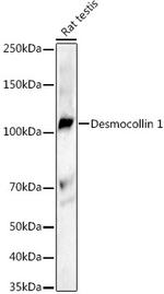 DSC1 Recombinant Rabbit Monoclonal Antibody (3U3Y2)