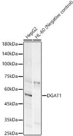 DGAT1 Recombinant Rabbit Monoclonal Antibody (9Q6A8)