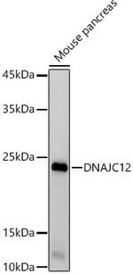 DNAJC12 Recombinant Rabbit Monoclonal Antibody (1A3U8)