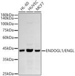 ENDOGL1 Recombinant Rabbit Monoclonal Antibody (2W6V1)