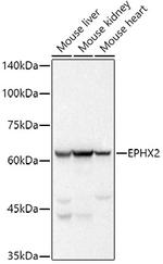 EPHX2 Recombinant Rabbit Monoclonal Antibody (8E2X2)