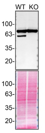 EPHX2 Antibody in Western Blot (WB)