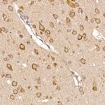 TXNDC12 Antibody in Immunohistochemistry (Paraffin) (IHC (P))