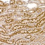 TXNDC12 Antibody in Immunohistochemistry (Paraffin) (IHC (P))