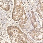 TXNDC12 Recombinant Rabbit Monoclonal Antibody (9J6L2)