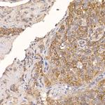 TXNDC12 Antibody in Immunohistochemistry (Paraffin) (IHC (P))