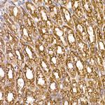TXNDC12 Antibody in Immunohistochemistry (Paraffin) (IHC (P))