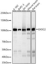 EXOC2 Recombinant Rabbit Monoclonal Antibody (5S2X9)