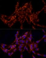FRAT1 Antibody in Immunocytochemistry (ICC/IF)