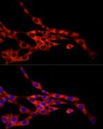 FRAT1 Antibody in Immunocytochemistry (ICC/IF)