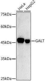 GALT Recombinant Rabbit Monoclonal Antibody (2R0A8)