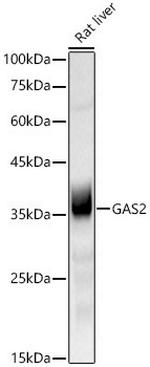 GAS2 Antibody in Western Blot (WB)