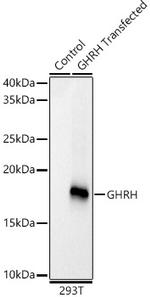 GHRH Recombinant Rabbit Monoclonal Antibody (8G5Y9)