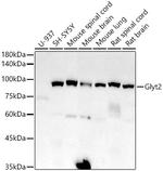 GlyT2 Recombinant Rabbit Monoclonal Antibody (1K1B2)