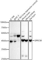 GPRC5B Recombinant Rabbit Monoclonal Antibody (8Y9J4)
