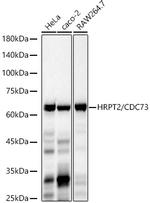 CDC73 Recombinant Rabbit Monoclonal Antibody (1B8Q1)
