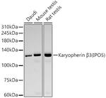 IPO5 Recombinant Rabbit Monoclonal Antibody (10K10W2)
