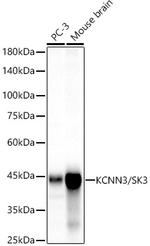 KCNN3 Recombinant Rabbit Monoclonal Antibody (3G7W0)