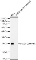 MFAP5 Recombinant Rabbit Monoclonal Antibody (8A1A5)