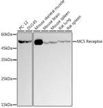 MC5R Recombinant Rabbit Monoclonal Antibody (1I1Q7)