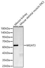 MGAT3 Recombinant Rabbit Monoclonal Antibody (4R7E2)
