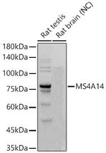 MS4A14 Recombinant Rabbit Monoclonal Antibody (1I9Z6)