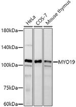 MYO19 Recombinant Rabbit Monoclonal Antibody (8S3V5)