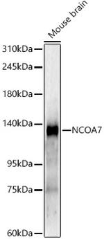 NCOA7 Recombinant Rabbit Monoclonal Antibody (5Q2U7)