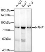NPHP1 Antibody in Western Blot (WB)