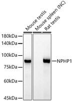 NPHP1 Recombinant Rabbit Monoclonal Antibody (6T10Z4)