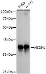NSDHL Recombinant Rabbit Monoclonal Antibody (3K3Q6)