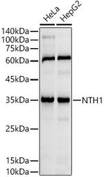 NTHL1 Recombinant Rabbit Monoclonal Antibody (8P6Z4)